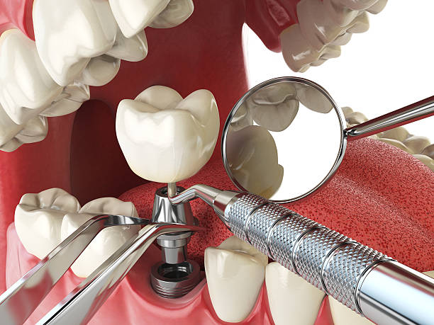 Best Emergency Treatment for Jaw Pain or Injury in North York, PA