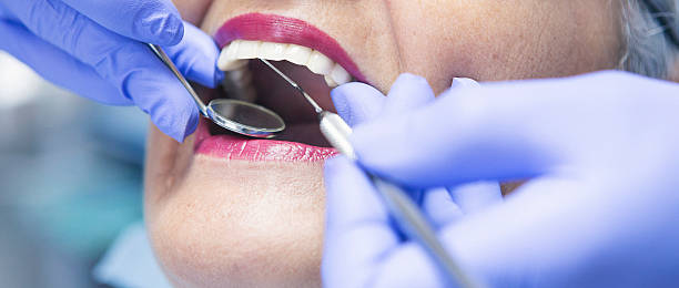 Best Emergency Wisdom Tooth Extraction in North York, PA
